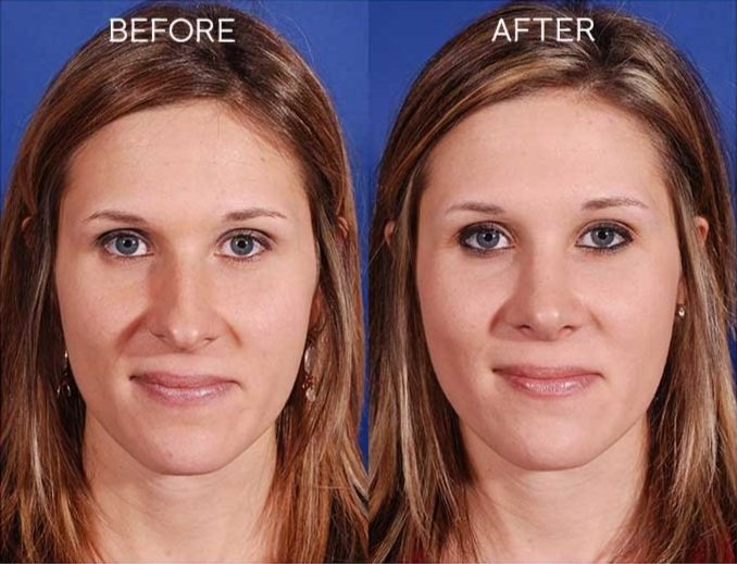 Top Plastic Surgeons In Austin